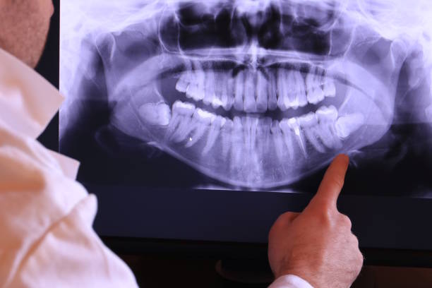 Best Urgent Tooth Repair  in Belle Rose, LA