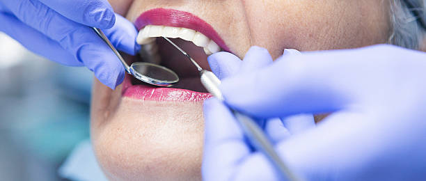 Best Emergency Dental Filling Replacement  in Belle Rose, LA